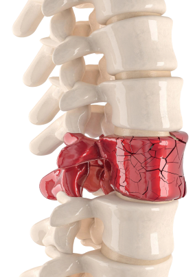 Pain management